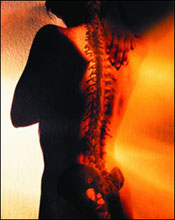 Sciatica Pain Relief Acupuncture Minneapolis