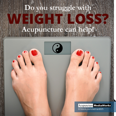 acupuncture weight loss