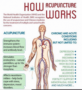 benefits of acupuncture