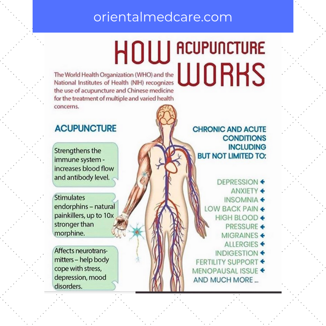benefits of acupuncture