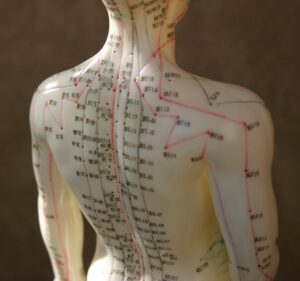 back pain acupuncture treatment