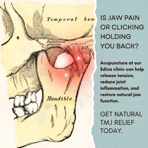 Vintage-style TMJ anatomical diagram highlighting jaw joint tension with glowing pressure points, alongside text promoting natural, drug-free TMJ relief and jaw function recovery at our Edina acupuncture clinic